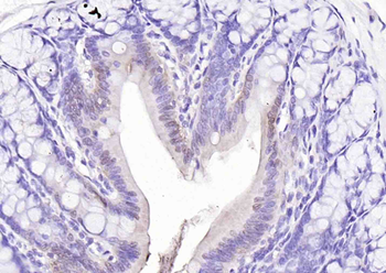 FAF1 Rabbit Polyclonal Antibody