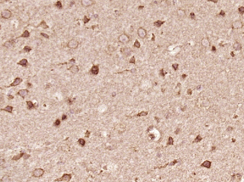 FE65 Rabbit Polyclonal Antibody