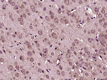 FGF1 Rabbit Polyclonal Antibody