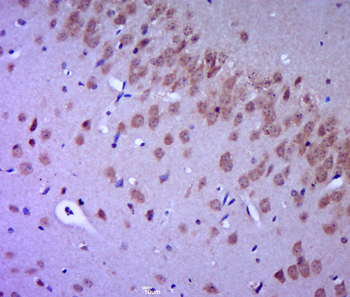 FGFR2 Rabbit Polyclonal Antibody