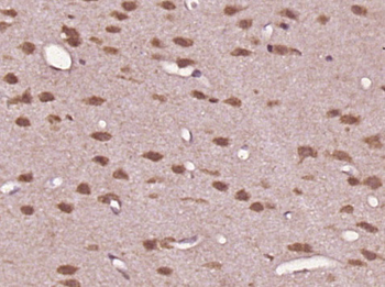 FOS B Rabbit Polyclonal Antibody