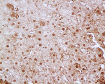 FoxP3 Rabbit Polyclonal Antibody