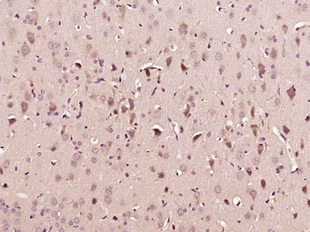 GABBR2 Rabbit Polyclonal Antibody