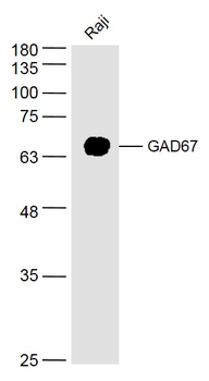 GAD67 Rabbit Polyclonal Antibody