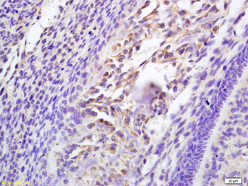Galectin 3 Rabbit Polyclonal Antibody