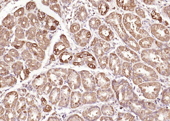 Galectin 3 Rabbit Polyclonal Antibody