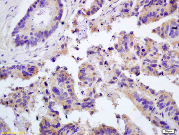 Galectin 3 Rabbit Polyclonal Antibody
