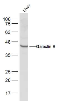 Galectin 9 Rabbit Polyclonal Antibody