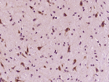 GDNF Rabbit Polyclonal Antibody