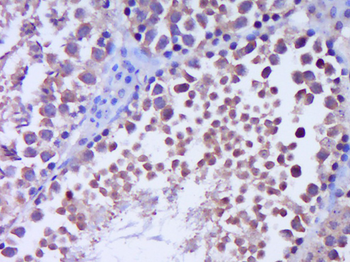 GLI1 Rabbit Polyclonal Antibody