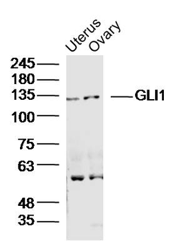 GLI1 Rabbit Polyclonal Antibody