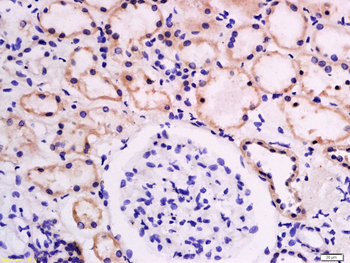 GLUT1 Rabbit Polyclonal Antibody