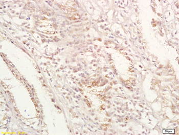 GPA33 Rabbit Polyclonal Antibody