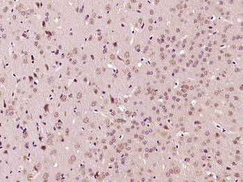Glucocorticoid receptor Rabbit Polyclonal Antibody