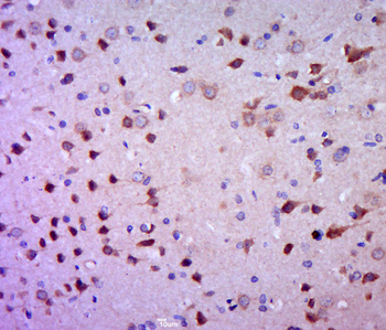 Glucocorticoid receptor Rabbit Polyclonal Antibody