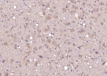 Glucocorticoid receptor Rabbit Polyclonal Antibody