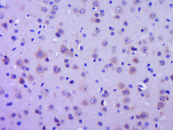 GPR30 Rabbit Polyclonal Antibody