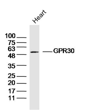 GPR30 Rabbit Polyclonal Antibody