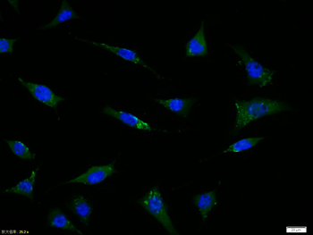 GPR30 Rabbit Polyclonal Antibody
