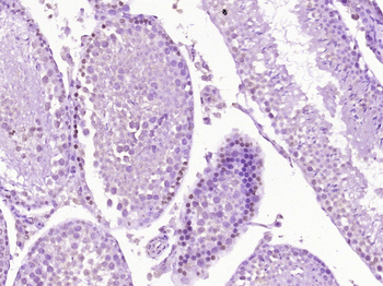 CTNND1 Rabbit Polyclonal Antibody