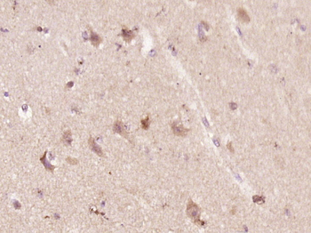 Gastrin Releasing Peptide Rabbit Polyclonal Antibody