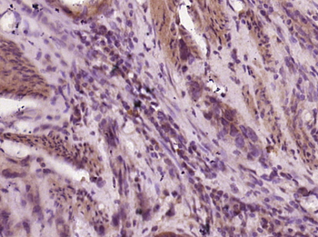 Gastrin Releasing Peptide Rabbit Polyclonal Antibody