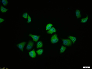 Phospho-GSK-3 Beta (Ser9) Rabbit Polyclonal Antibody