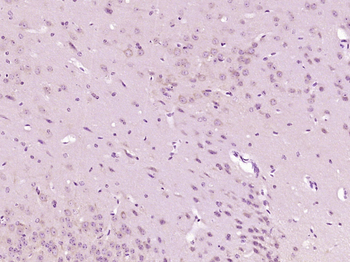 GTP cyclohydrolase 1 Rabbit Polyclonal Antibody