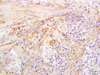 Hyaluronidase-1 Rabbit Polyclonal Antibody