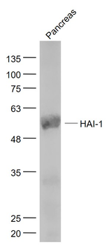 HAI-1 Rabbit Polyclonal Antibody