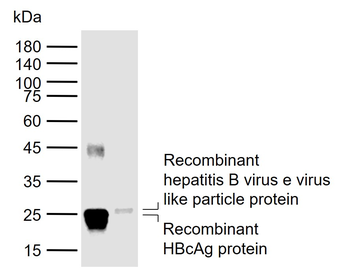 HBeAg Mouse Monoclonal Antibody