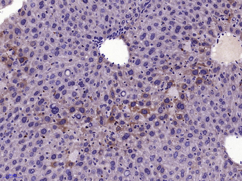 HGF Rabbit Polyclonal Antibody