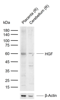 HGF Rabbit Polyclonal Antibody