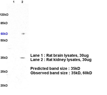 HLA G Rabbit Polyclonal Antibody
