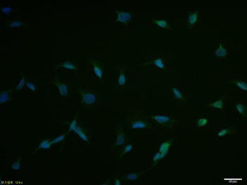 HNF1A Rabbit Polyclonal Antibody