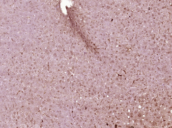 HNF1A Rabbit Polyclonal Antibody