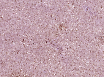 HNF1A Rabbit Polyclonal Antibody