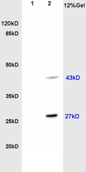 HOXc8 Rabbit Polyclonal Antibody