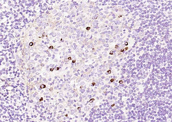 Human IgM Mouse Monoclonal Antibody