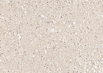 HSTF2 Rabbit Polyclonal Antibody