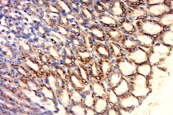HSP60 Rabbit Polyclonal Antibody