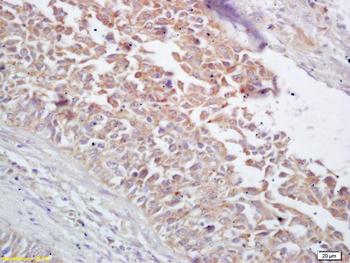 HSP60 Rabbit Polyclonal Antibody
