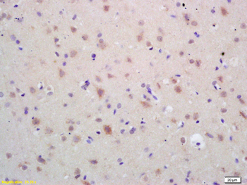 HSP60 Rabbit Polyclonal Antibody