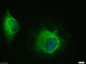 HSP70 Rabbit Polyclonal Antibody