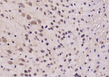 C20orf160 Rabbit Polyclonal Antibody