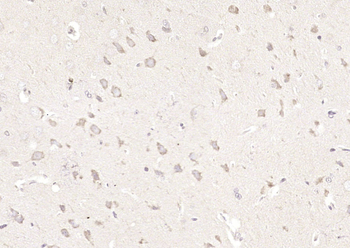 Staufen Rabbit Polyclonal Antibody