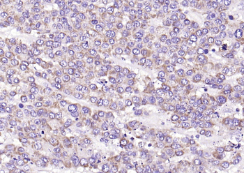 IFNB1 Rabbit Polyclonal Antibody