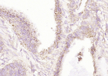 IFNB1 Rabbit Polyclonal Antibody