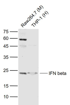IFNB1 Rabbit Polyclonal Antibody
