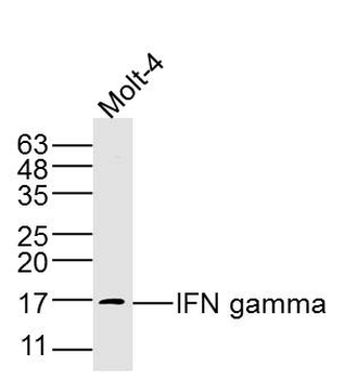 IFN gamma Rabbit Polyclonal Antibody